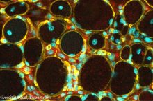 Unheilbare Muskelkrankheit: Erste Erfolge bei der Entwicklung einer Gentherapie