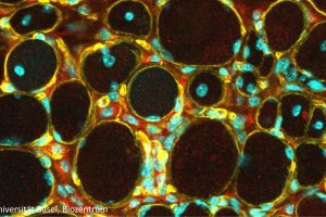 Unheilbare Muskelkrankheit: Erste Erfolge bei der Entwicklung einer Gentherapie