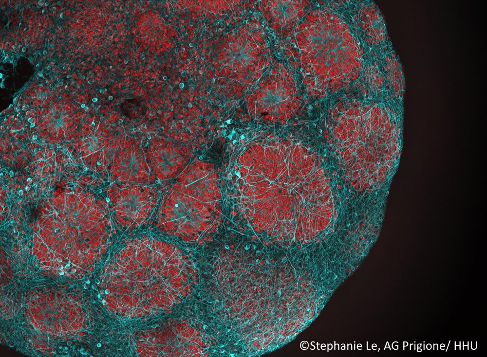 Veröffentlichung in Cell: Neuer Therapieansatz bei Leigh-Syndrom