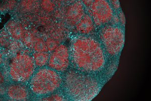 Veröffentlichung in Cell: Neuer Therapieansatz bei Leigh-Syndrom