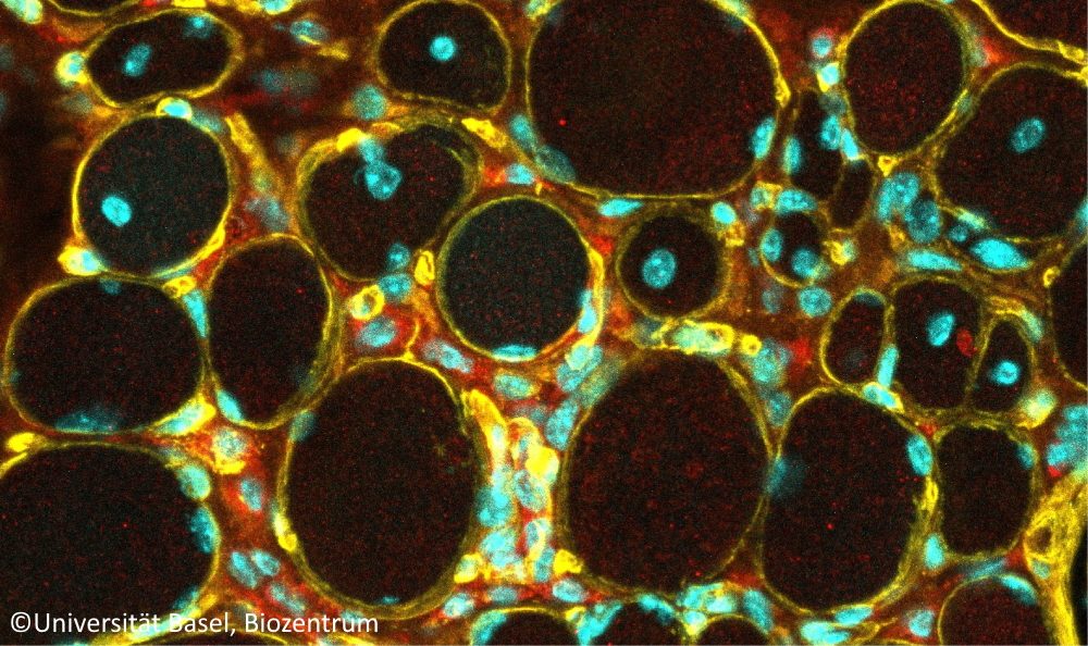 Unheilbare Muskelkrankheit: Erste Erfolge bei der Entwicklung einer Gentherapie