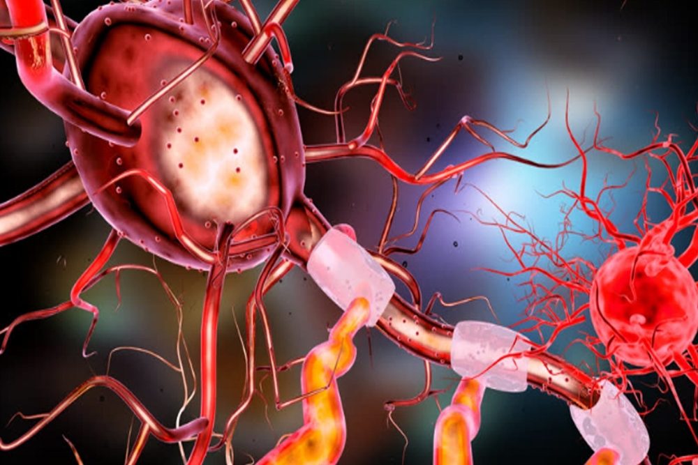 Orale Therapie der spinalen Muskelatrophie bald verfügbar?